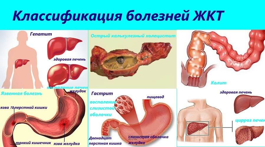 Неоформленный стул при холецистите